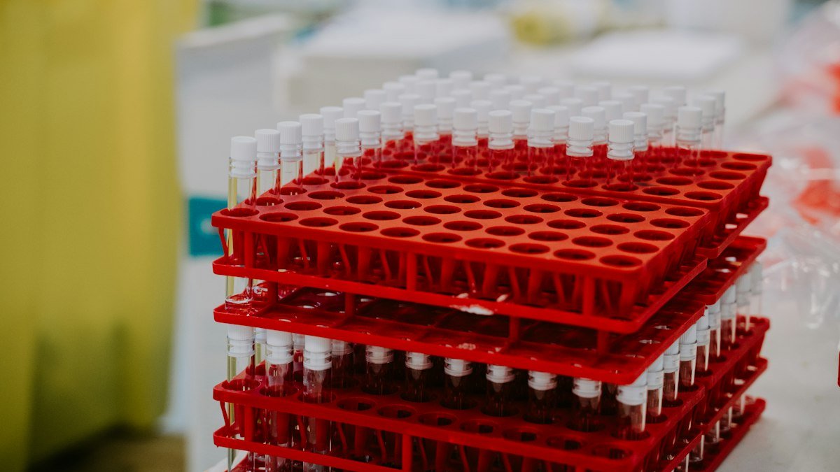 Quelle pureté pour LC-MS en analyse des peptides